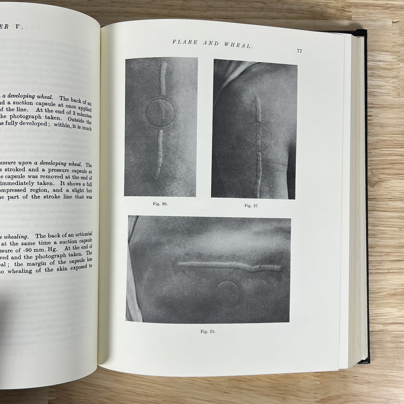 Blood Vessels of Human Skin Classics of Medicine Library Gryphon Leather Lewis