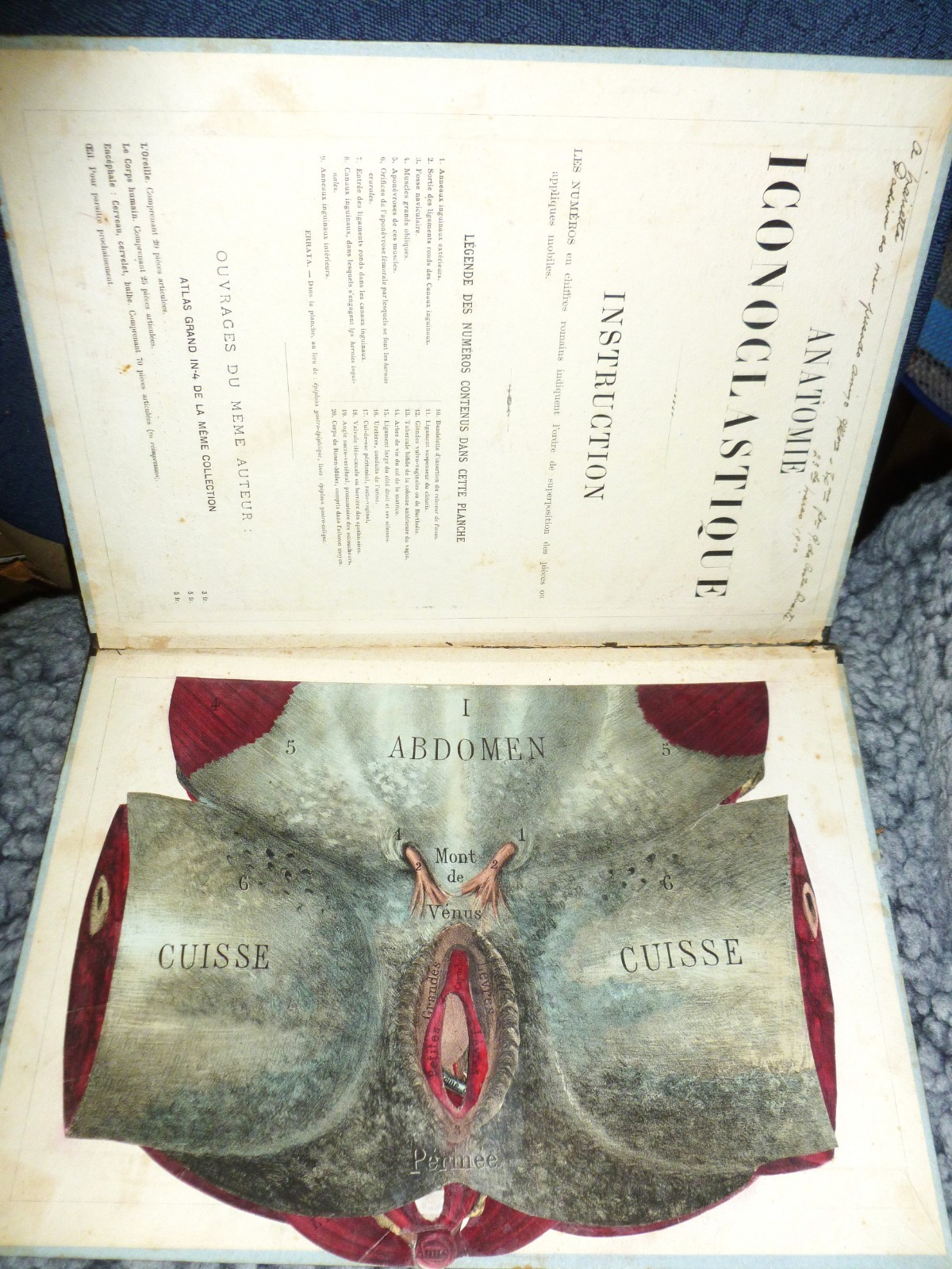 Antique 1874 Fold-Out Layers Of WOMEN’S GENITAL ANATOMY Paris, France VG Cond