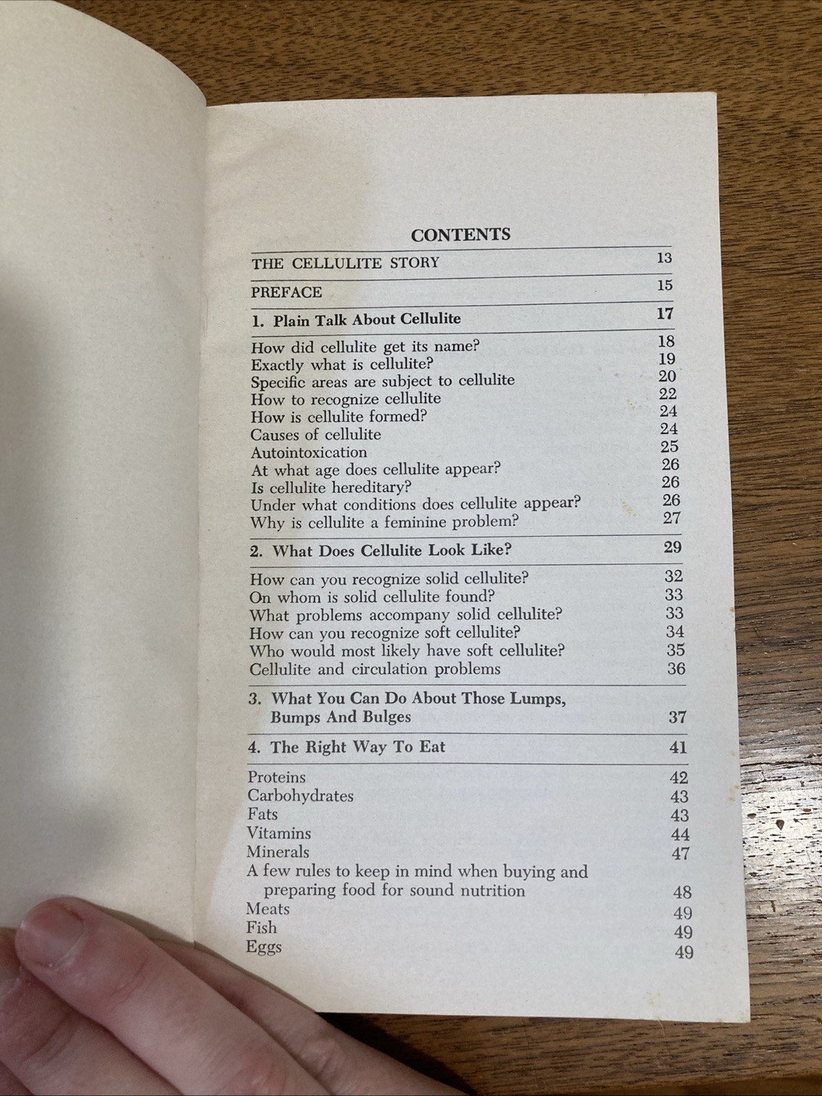 Cellulite: Those Lumps, Bumps And Bulges You Couldn’t Lose Before Book Vtg 1975